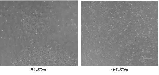 原代細(xì)胞和傳代細(xì)胞的區(qū)別